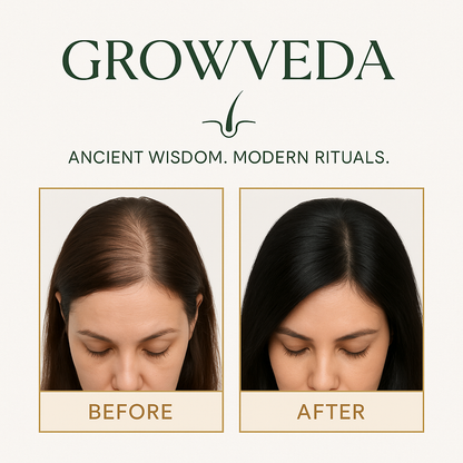 Growveda Ayurvedic Hair Oil